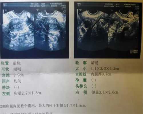 上海专业代孕成功率,在上海做试管婴儿要多少钱（中介收费34926元）