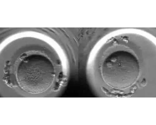 上海靠谱代孕公司,上海试管婴儿选性别【有什么成功的秘诀】