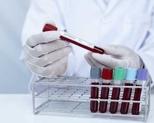 上海代孕较好医院,去上海做试管婴儿疼不疼做试管婴儿手术疼不疼