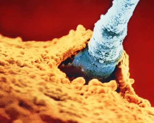 上海代怀孕网供卵,上海试管婴儿中介机构哪家比较好？