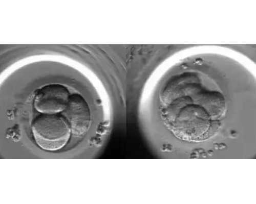 上海代孕医院哪家好,月经不调吃什么能来月经上海明珠医院