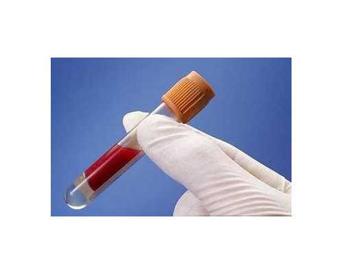 上海代怀网联系方式,上海高龄夫妻不孕不育率上升备孕要注意什么