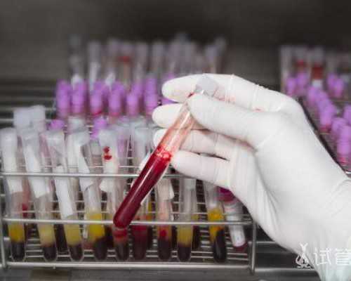 代生供卵代怀~做试管婴儿压力大怎么办