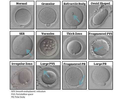 上海怎么找借腹生子中介,上海供卵试管价格多少钱,【上海代孕基地，孕育奇迹