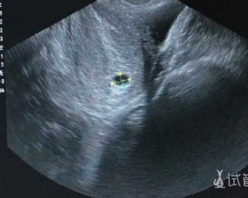 有姐妹知道婴儿补铁排名前三的牌子都有哪些吗？求分享！