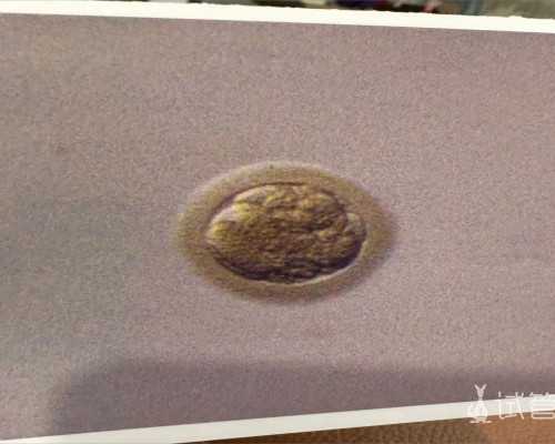 上海最大的代怀,【上海哪家医院做供卵试管婴儿好】先破水14个小时超快顺产，