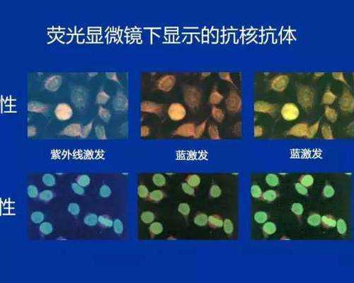 上海代怀产子,试管婴儿移植后出血是怎么回事_上海有没有供卵机构-上海供卵试