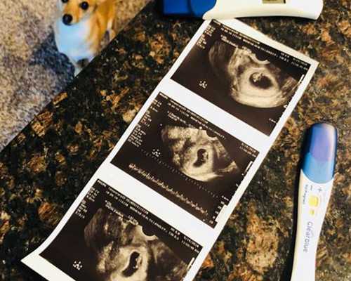 上海专业代孕成功率,在上海做试管婴儿要多少钱（中介收费34926元）