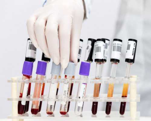 上海去代怀孕靠谱吗,上海瑞金医院试管婴儿攻略：除了费用你得还知道什么？