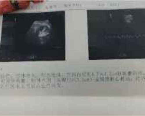 上海捐卵多少钱,上海捐卵试管有无风险-代孕哪个正规