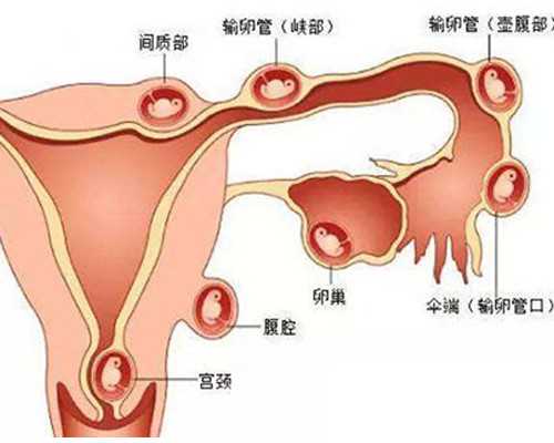 上海二代供卵供卵代孕,上海急找代生,柳州妇幼保健院供卵代孕得龙凤胎概率大
