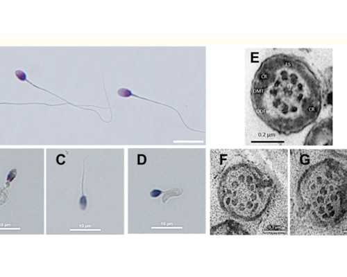 上海借卵自怀费用,泰国第三代供卵代孕婴儿检查项目有哪些？_上海供卵供卵代
