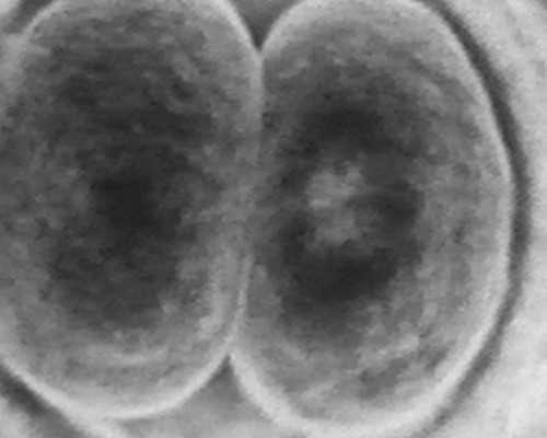 试管婴儿移植胚胎后可不可以吃巧克力